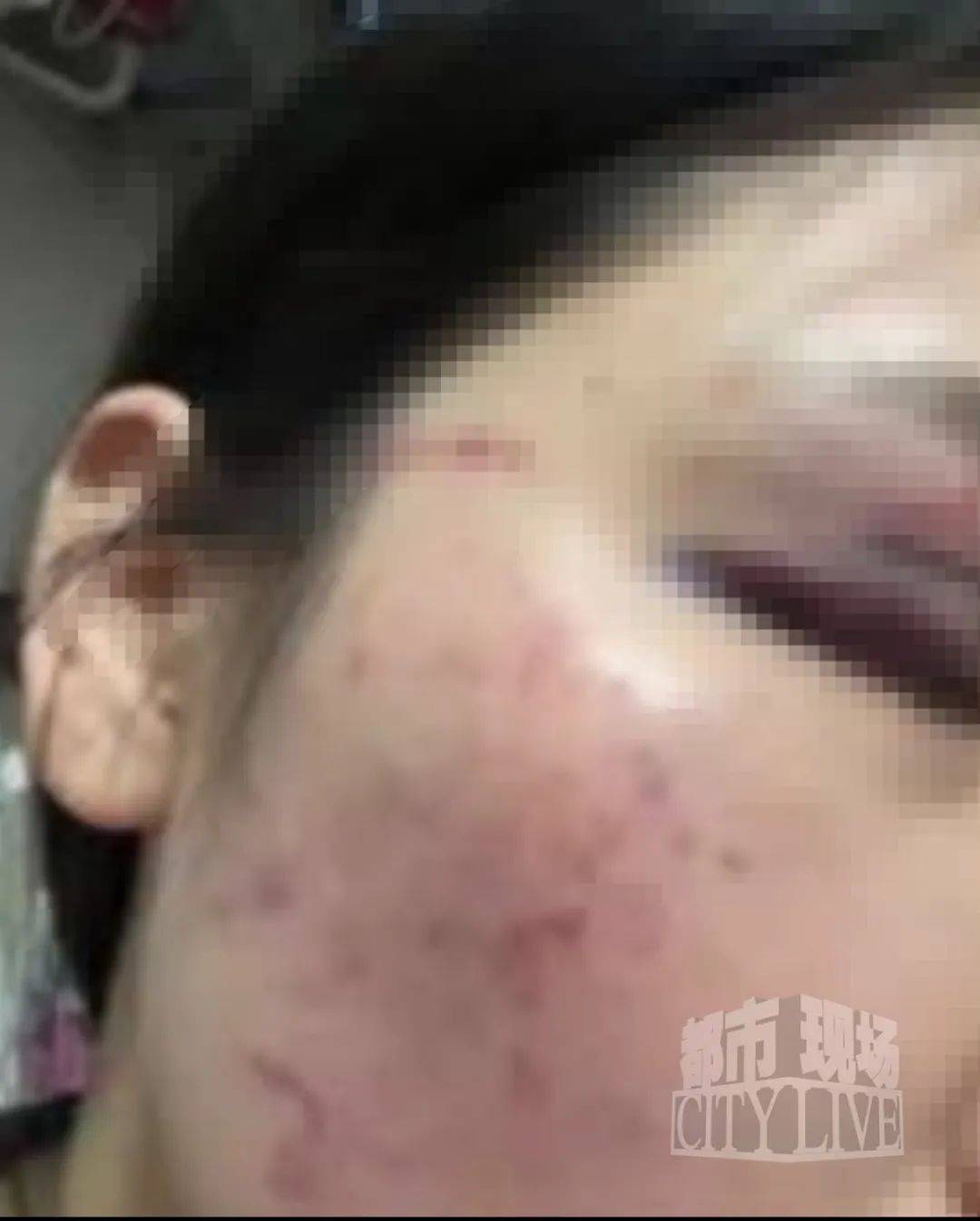 皇冠信用網最高占成
_湖南衡阳29岁女子疑被男友施暴后从25楼跳下身亡 男友徐某此前还刺激说：“你放心皇冠信用網最高占成
，她不会去死的”